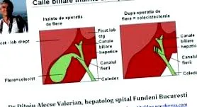 vasat
