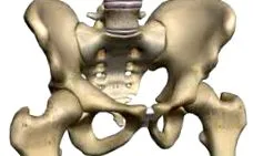 érintett hemipelvis