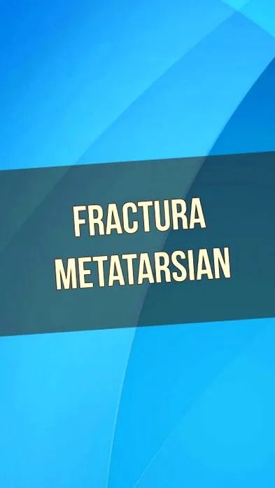 metatarsalis