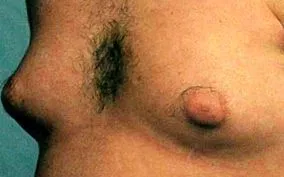 calu