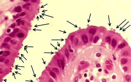 limbricii