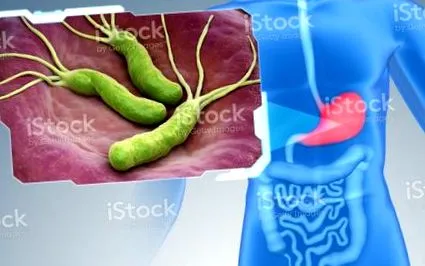 pylori románok