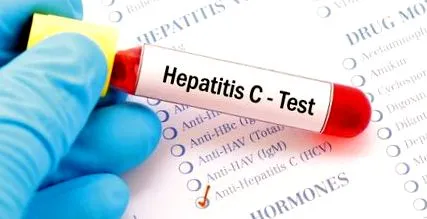 hepatitis vírus