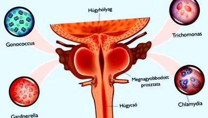 Urovaxon prosztata