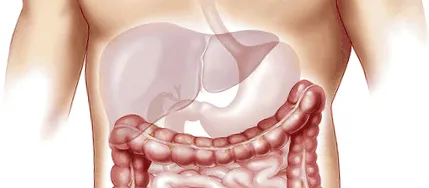 útmutató ileostomia