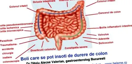 hosszú dolicocolon