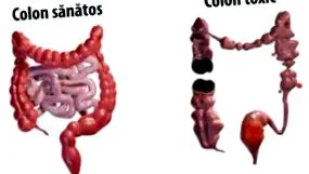 fontos fontos
