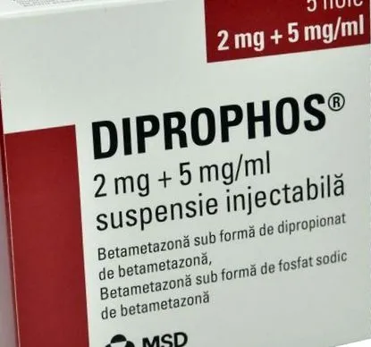 ízületi kyphosis