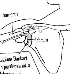 glenoid üregben