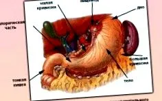 osteoarthritis