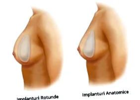 szilikon implantátummal