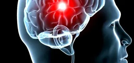 glioblastoma terápiás