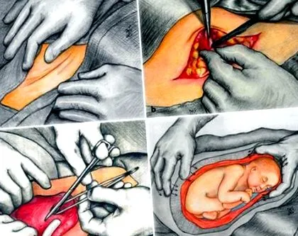 medlife