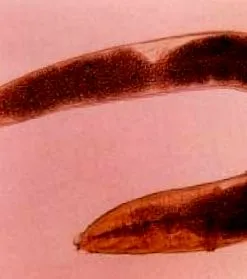 oxiuri