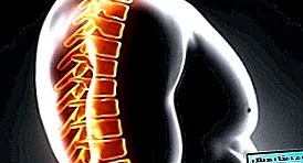 osteochondrosisai gerinckészítmények