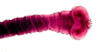 Bélparazitózis giardiasis