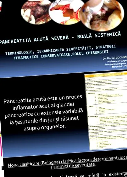 панкреатитис