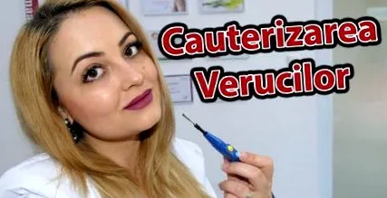papillómák