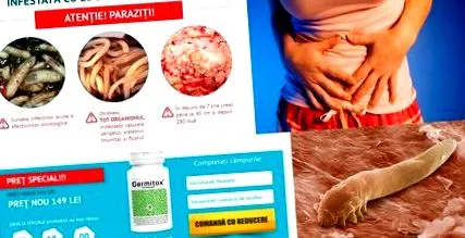 giardia fertőzés