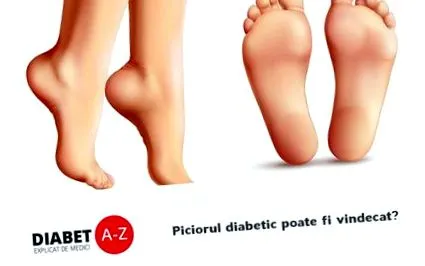 diabetes-az