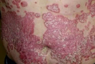 dermatology