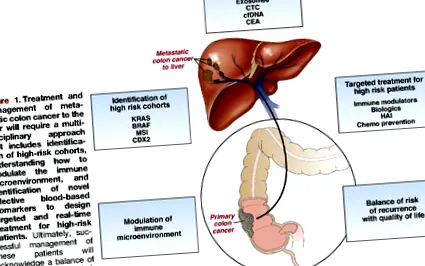 Oxyurosis Enterobiosis Diéta