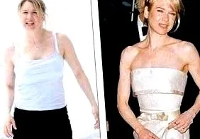 renee