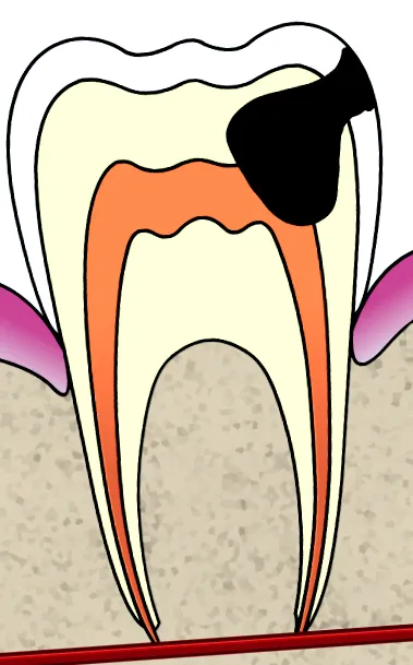 túlzott