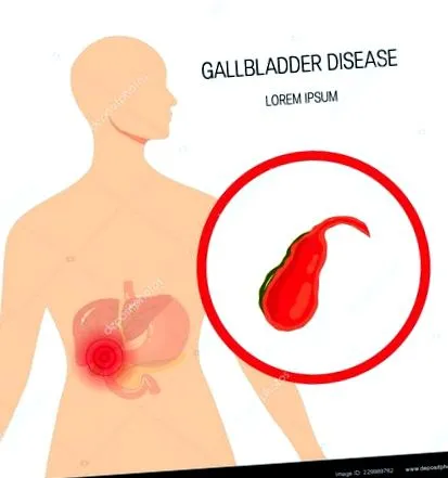 prezența organism