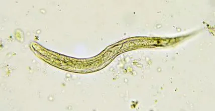 инфекция whipworm