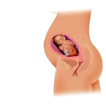 mária