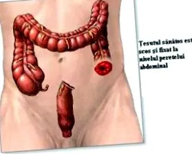 stomas gyulladásos