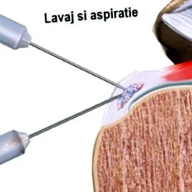 váll