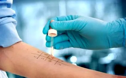 allergia diagnosztizálására allergia