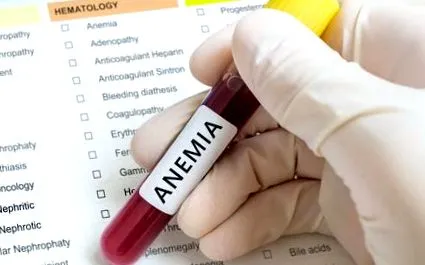 анемија