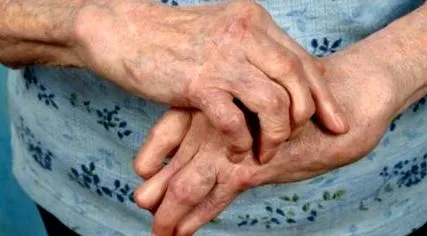 osteoarthritis duzzanat
