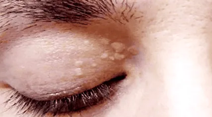 експертиза