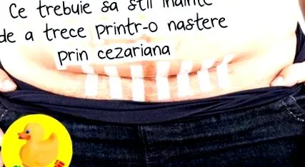 császármetszésen