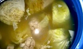 giardiasis