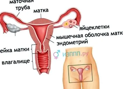 ureaplasmosis