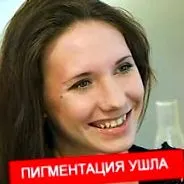 hialuronsav