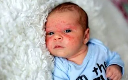 arcán vagy