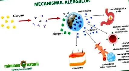 parlagfűallergia