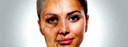 amelyeket