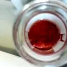 апендиксит