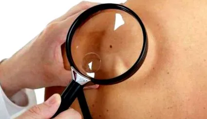 prečo epoch