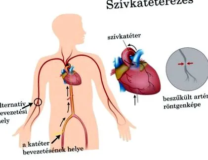 коли потрібно
