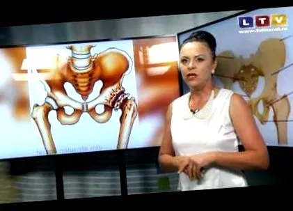 osteoarthritis osteoarthritis