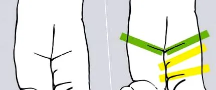 artróza