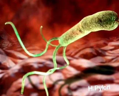 Helicobacter pylori